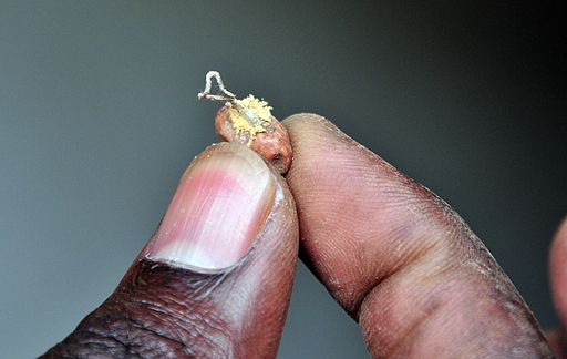 Picture of a person finger's holding a bean affected by aflatoxin.